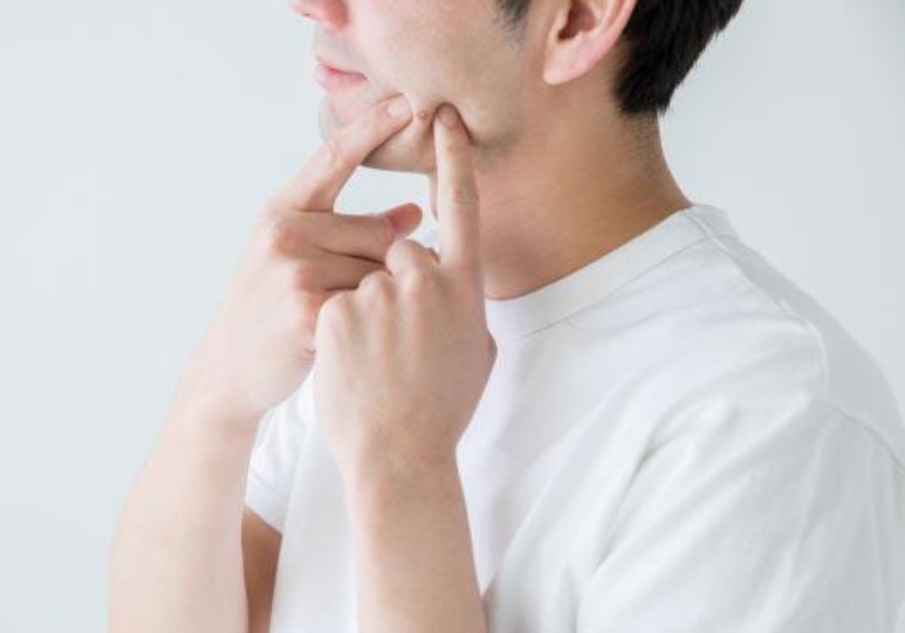 causes of acne on mens face 04. - 男士如何改善痘痘肌肤？