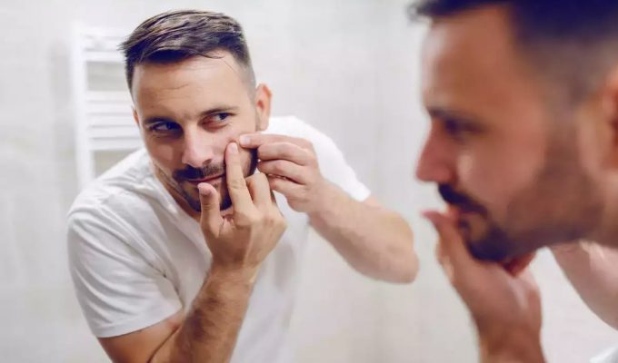 man acne problem tips 680x400 - 男士护肤指南：减轻痘痘和暗疮问题