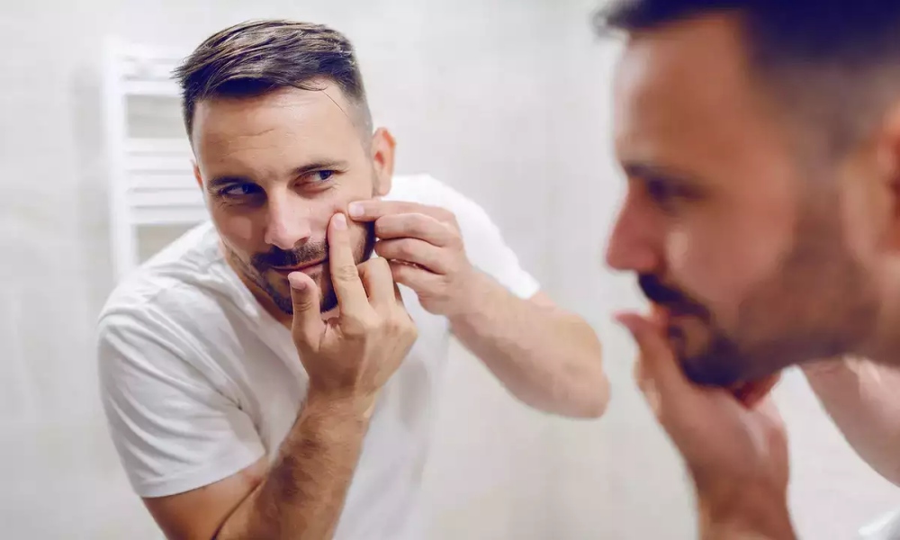 man acne problem tips - 男士护肤指南：减轻痘痘和暗疮问题