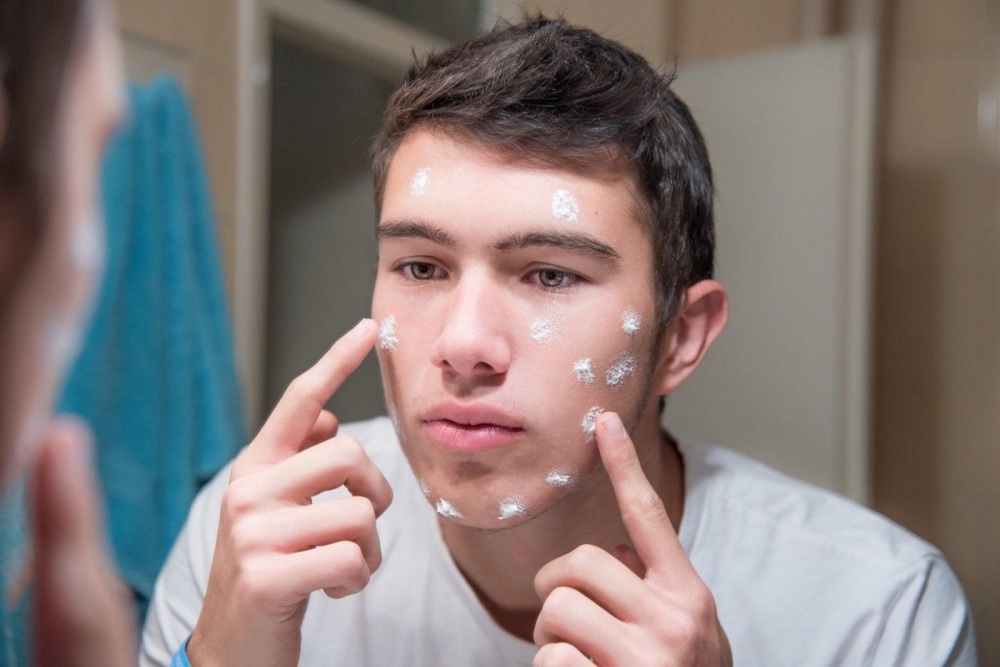 man acne problem skincare - 男士护肤指南：减轻痘痘和暗疮问题